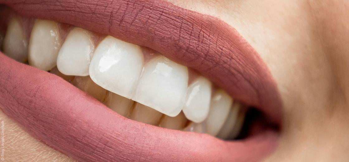 Mit Veneers zu schönen und geraden Zähnen: Was müssen Nutzer beachten?